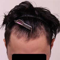 症例写真57