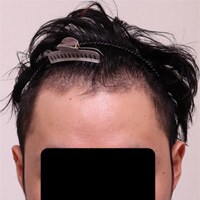 症例写真59