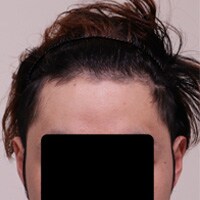 症例写真60