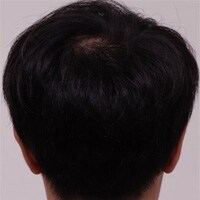 症例写真61