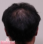 症例写真67