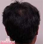症例写真68