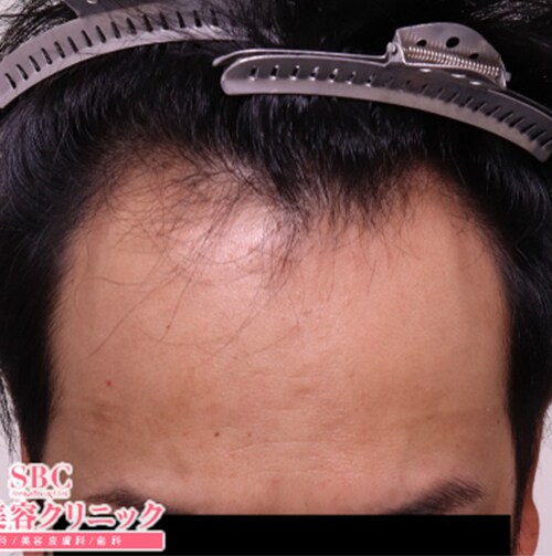 症例写真69