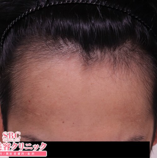 症例写真70