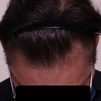 症例写真72
