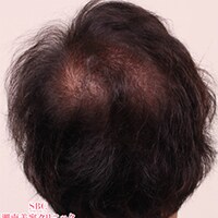 症例写真75