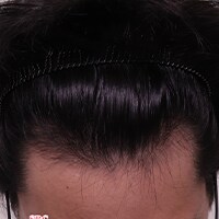 症例写真78