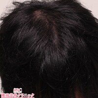 症例写真79