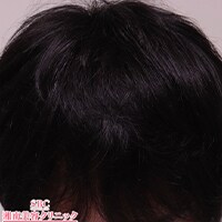 症例写真80