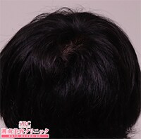 症例写真82