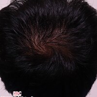 症例写真83