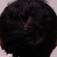 症例写真84