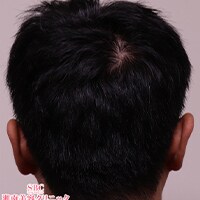 症例写真86