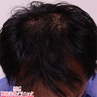 症例写真87