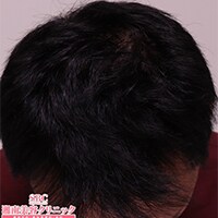 症例写真88