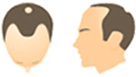 ステージ１