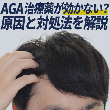 AGA治療薬が効かない？薄毛のお悩みは湘南AGAクリニック福岡院で解決
