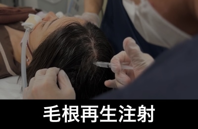 【1回の治療、3ヶ月で劇的発毛】毛根再生注射