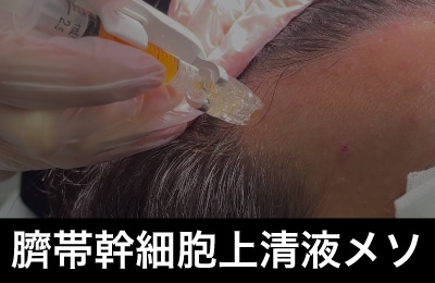 【1,000種以上の成長因子使用】臍帯幹細胞上清液メソ