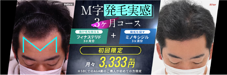【おすすめ】M字発毛実感3ヶ月コース/10,000円