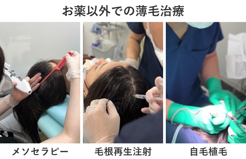 メソセラピー