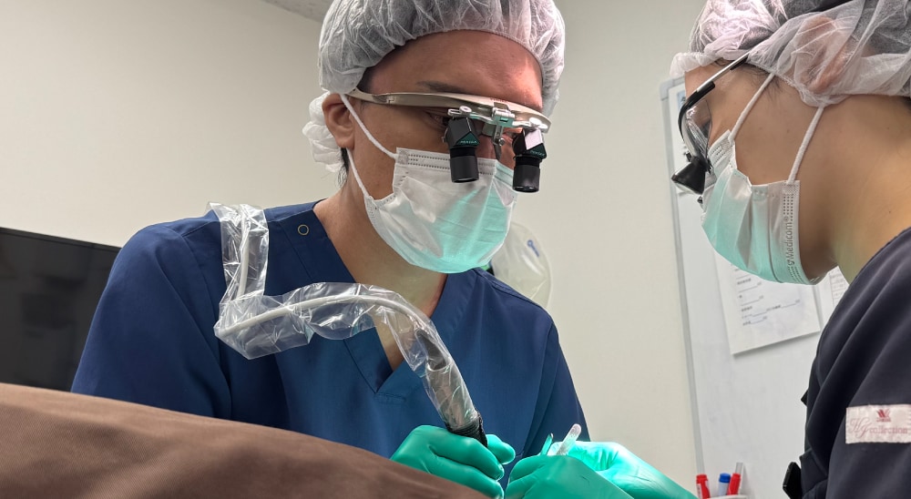 人気は刈り上げないノンシェーブン植毛!