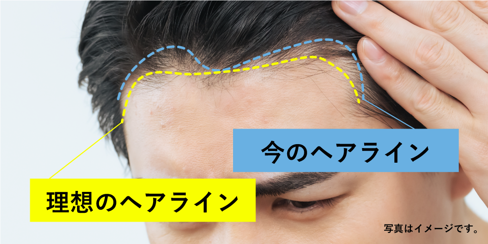 デザインが不自然