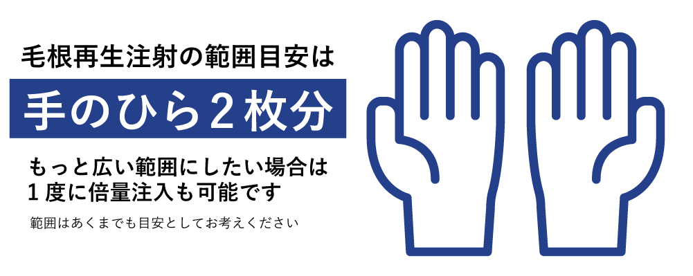 毛根再生注射の治療範囲は?