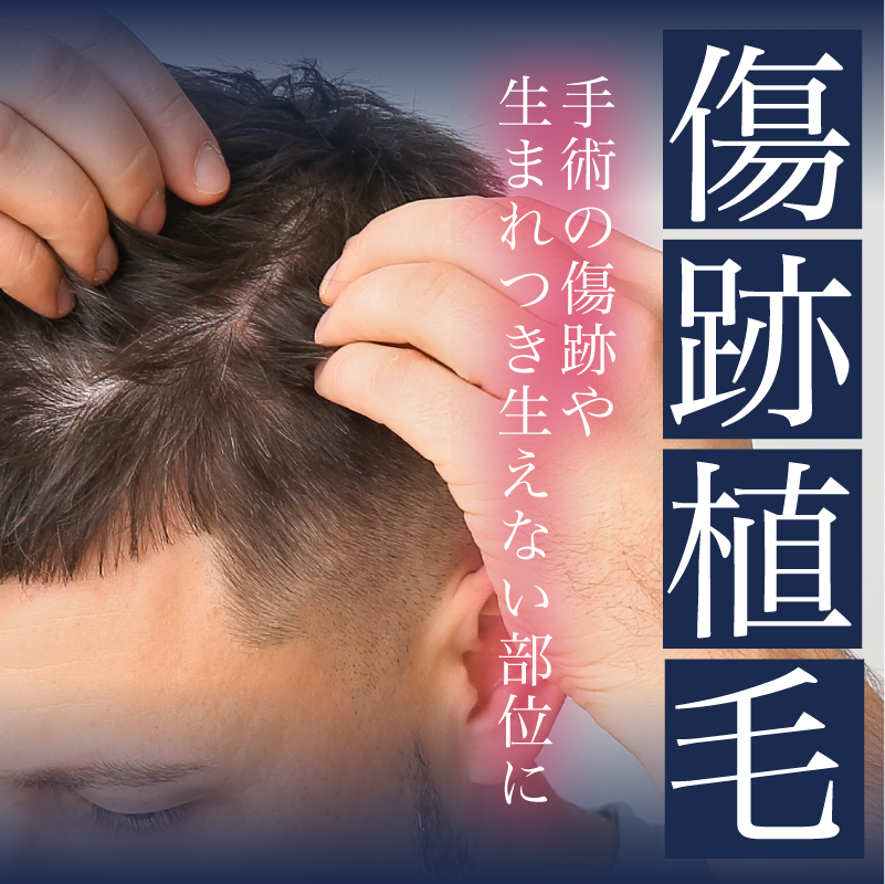 【傷跡・生まれつき】瘢痕への自毛植毛ならAGA福岡院にお任せください