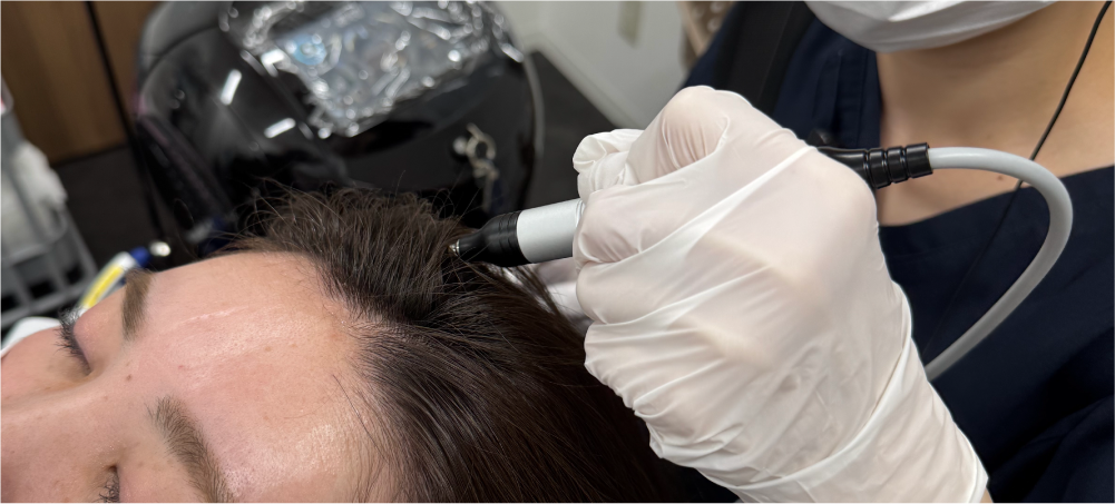 エレクトロポレーションメソ