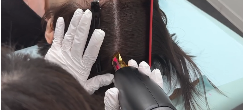 【日本ではSBCが初導入】FoLixレーザー