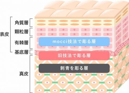 皮膚の「浅い層」に入れるからダメージが少ない