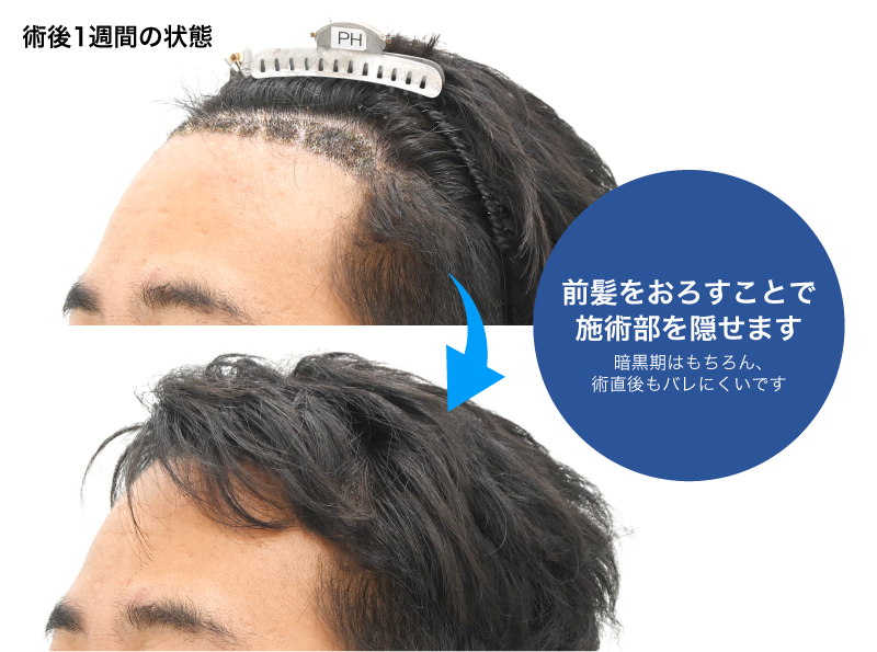 前髪を少し長めに残しておく