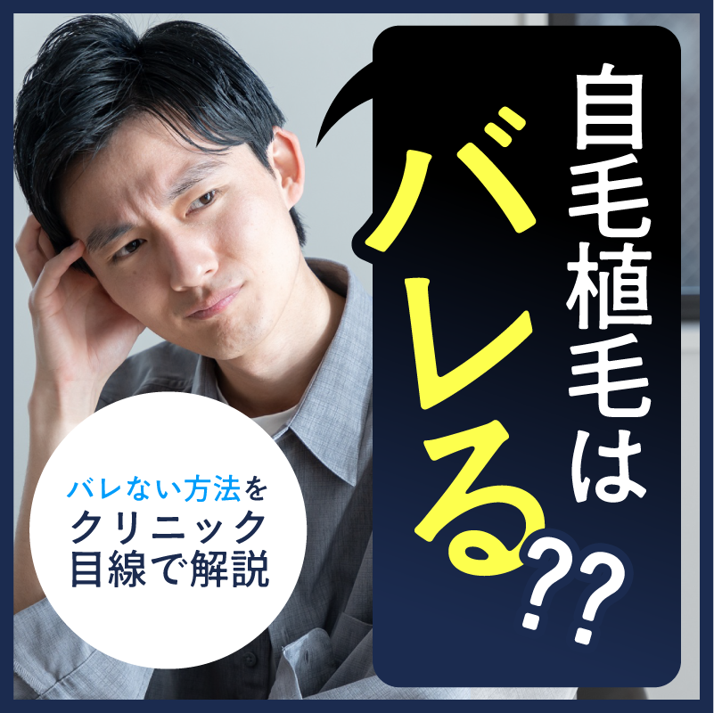 自毛植毛はバレる？バレない方法をクリニック目線で解説