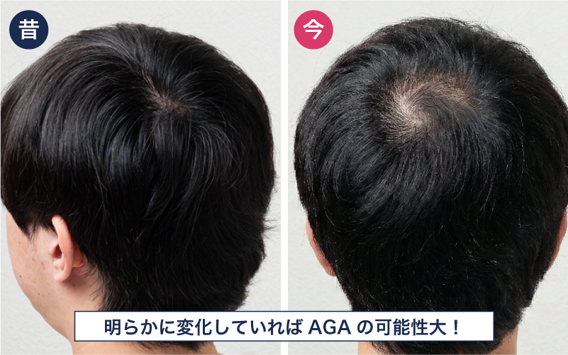 昔の写真との比較