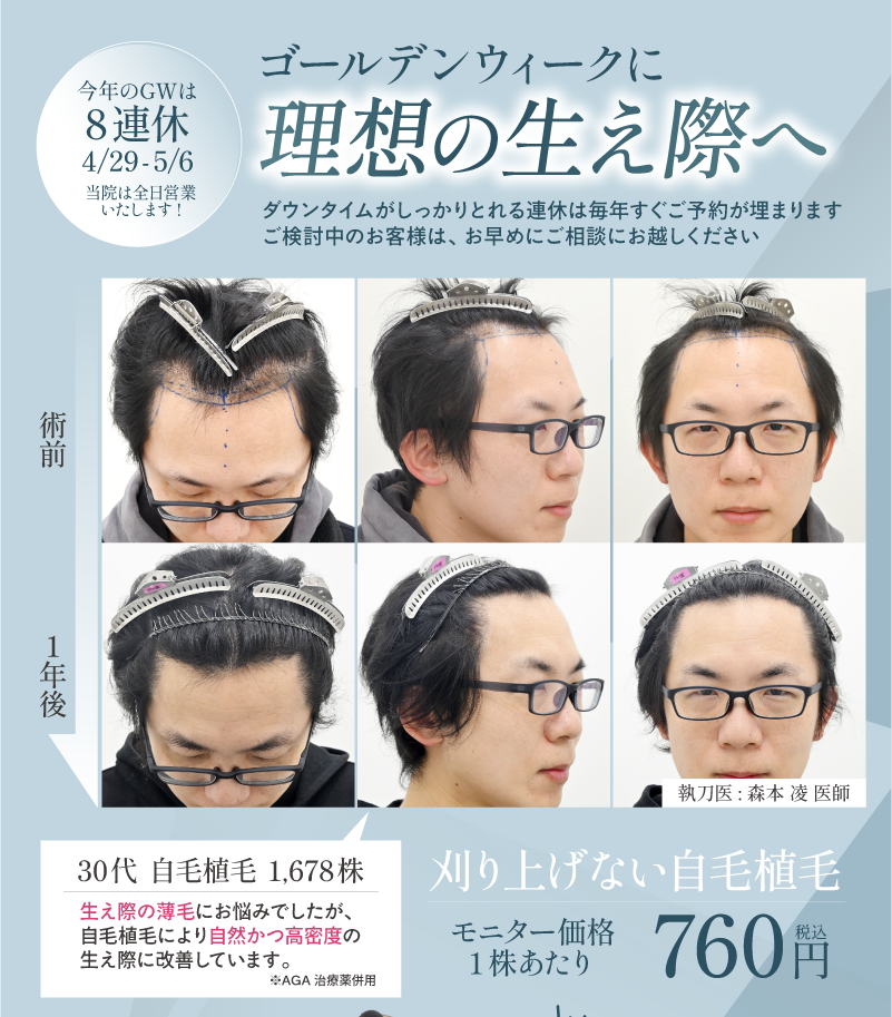 画像の説明を記載