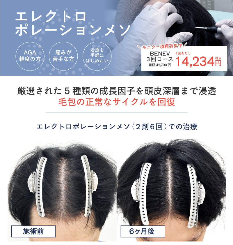 画像の説明を記載