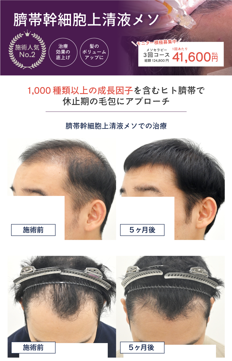 画像の説明を記載