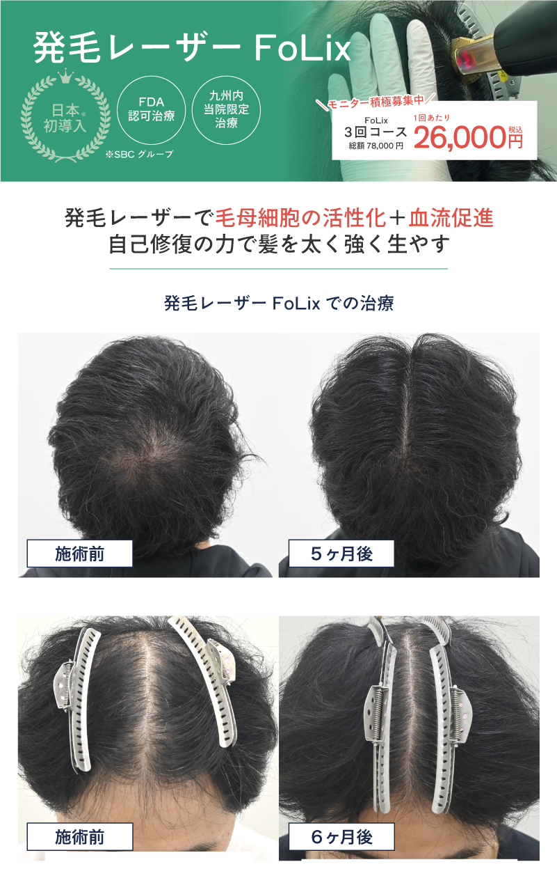 画像の説明を記載