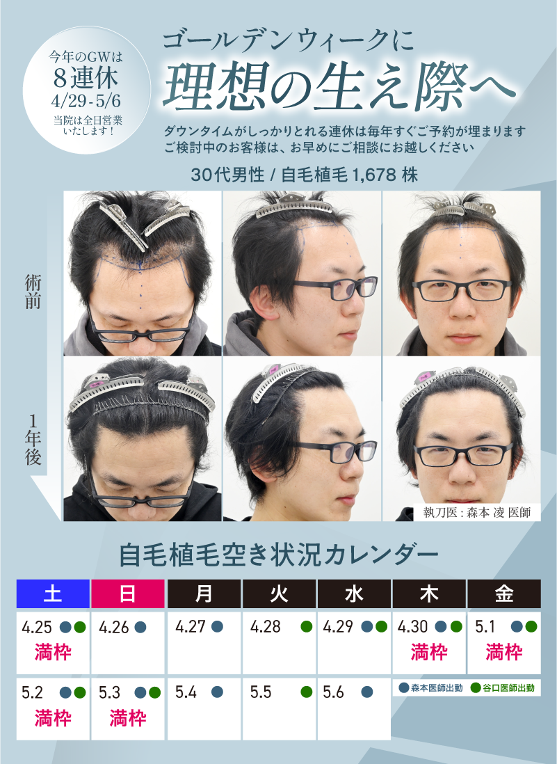 画像の説明を記載