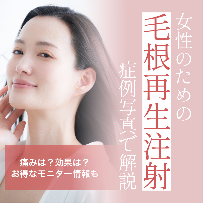 毛根再生注射は女性にも効く？自身の細胞で髪を増やす話題の治療を解説