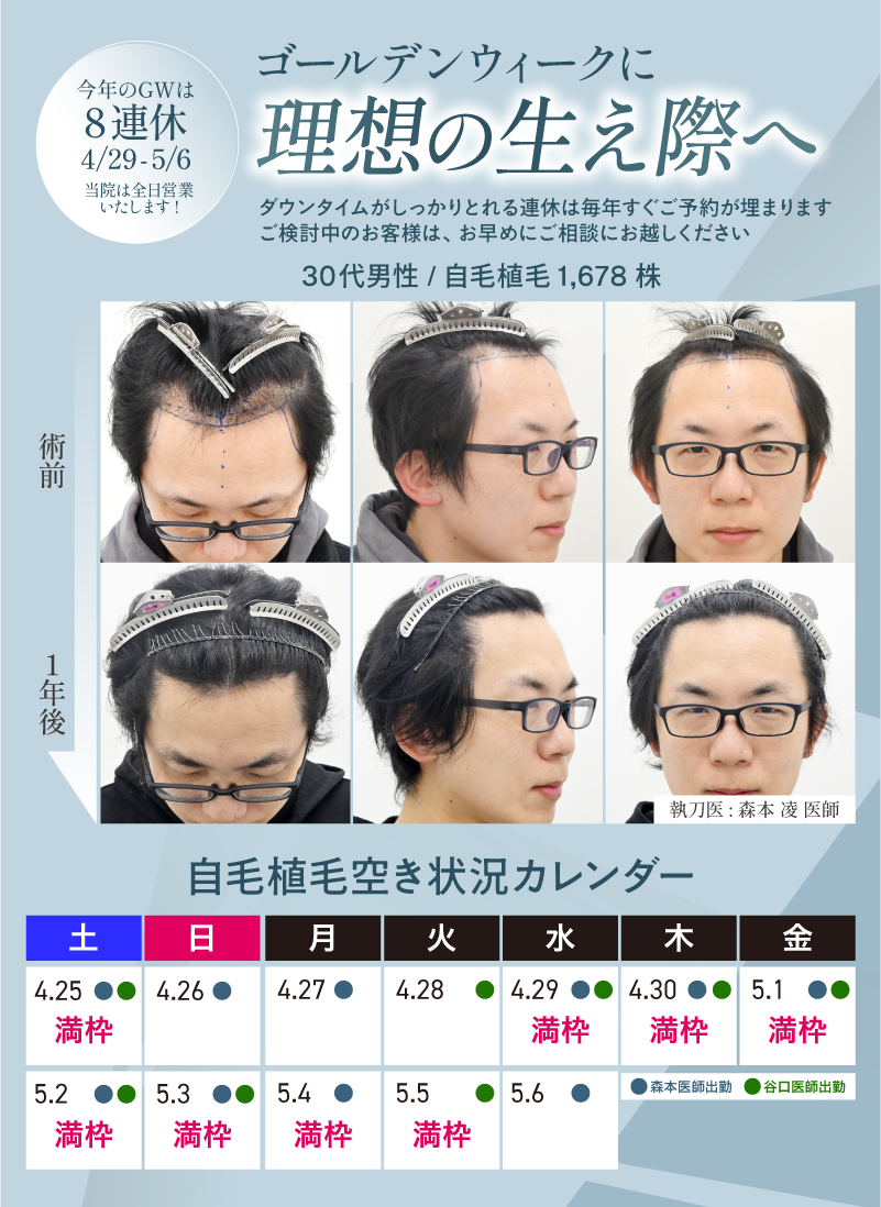 画像の説明を記載