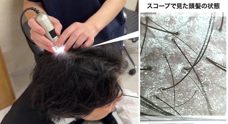 マイクロスコープによる診断