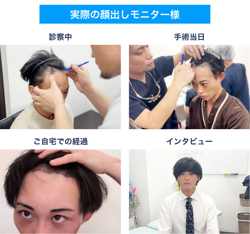 実際の顔出しモニター様をご紹介