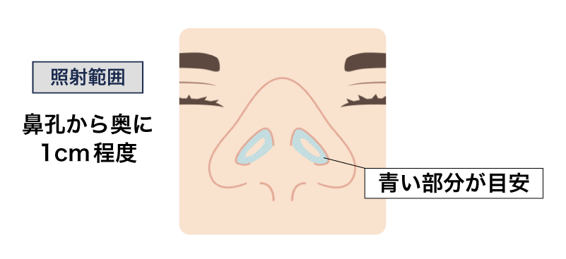 施術範囲
