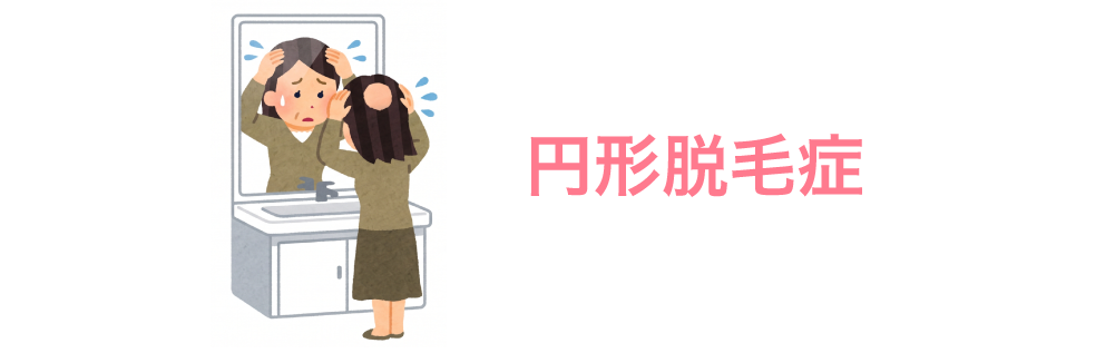円形脱毛症