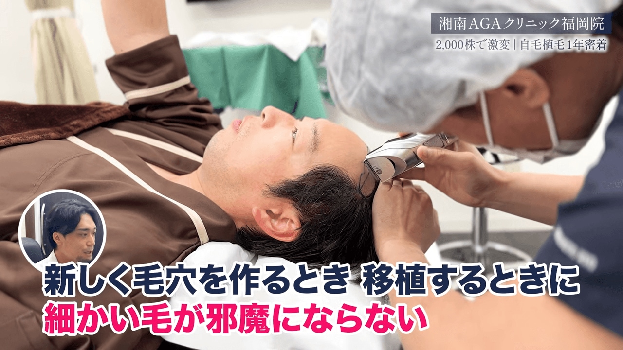 髪の毛の剃毛(ていもう)