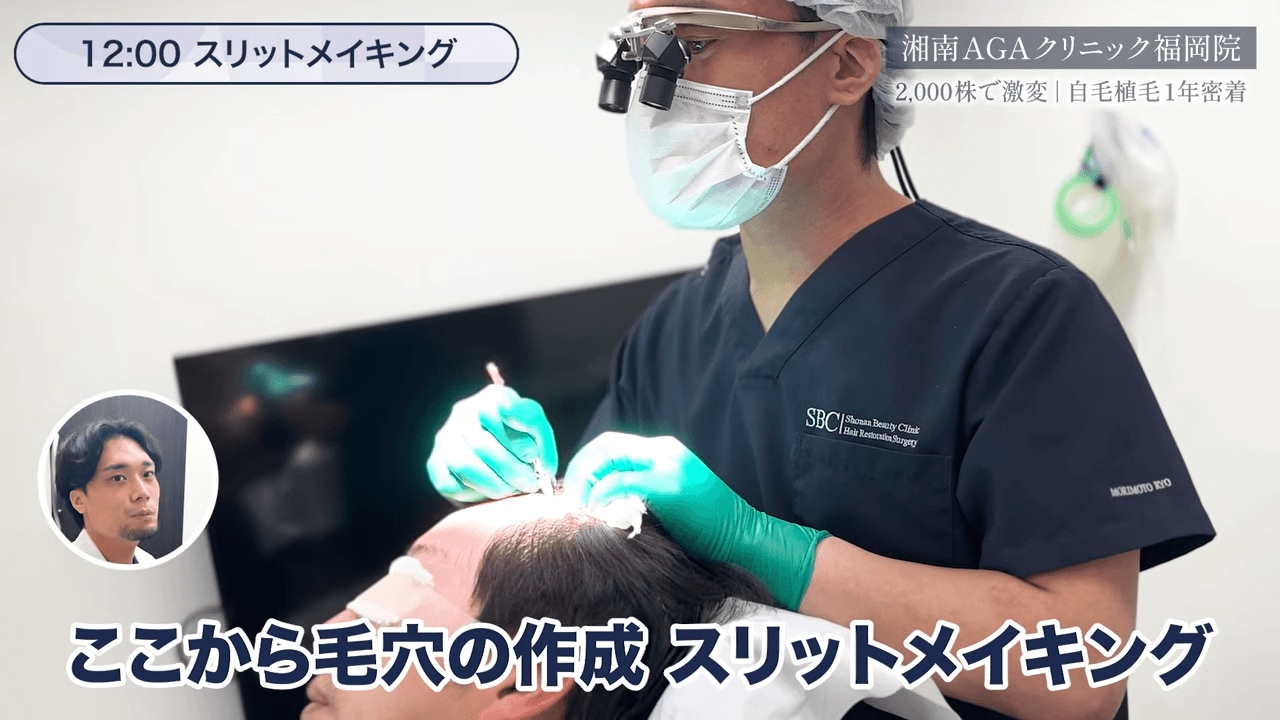 毛穴作成(スリットメイキング)