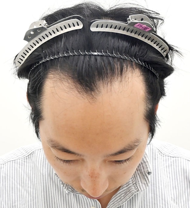 30代 男性のお客様