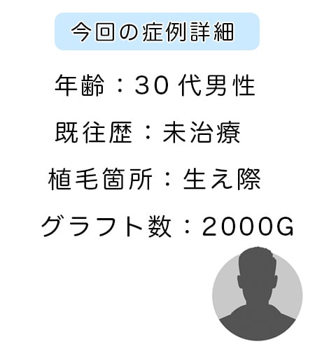 髪を掻き上げたい！